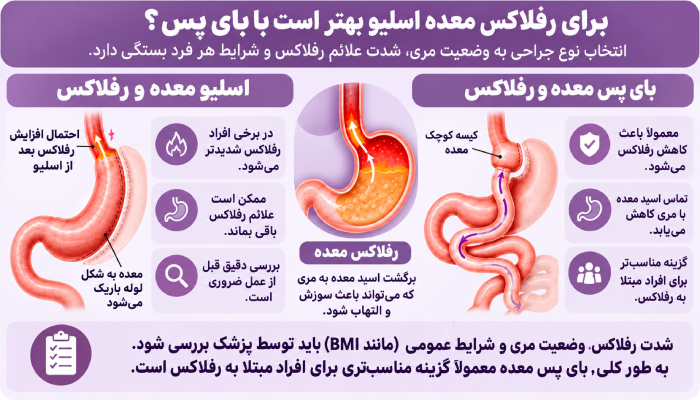 برای رفلاکس معده اسلیو بهتر است یا بای پس؟