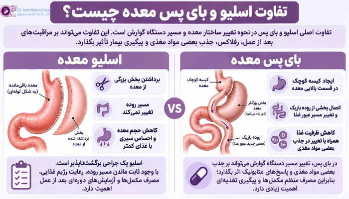 تفاوت اسلیو و بای پس معده چیست؟