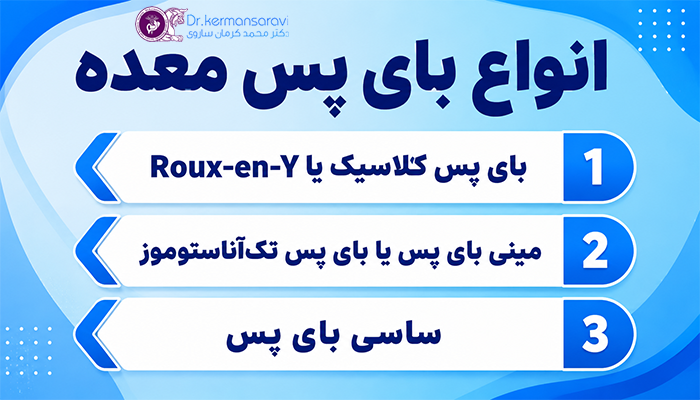 انواع بای پس معده
