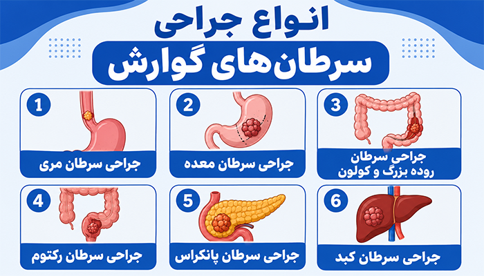 انواع جراحی سرطان گوارش