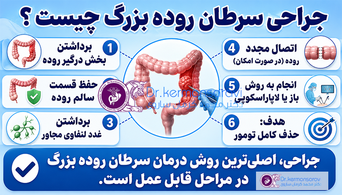 جراحی سرطان روده بزرگ چیست؟