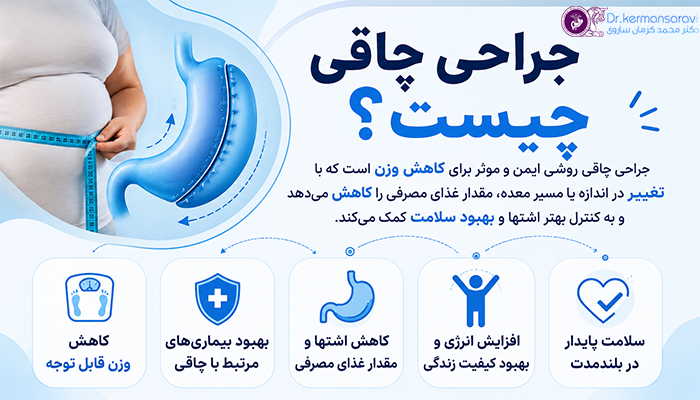 جراحی چاقی چیست؟