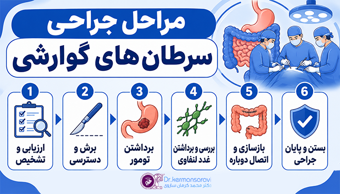 مراحل جراحی سرطان های گوارشی