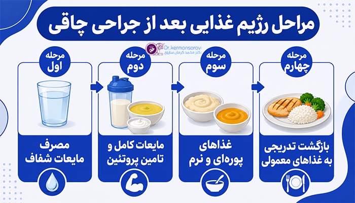 مراحل رژیم غذایی بعد از جراحی چاقی