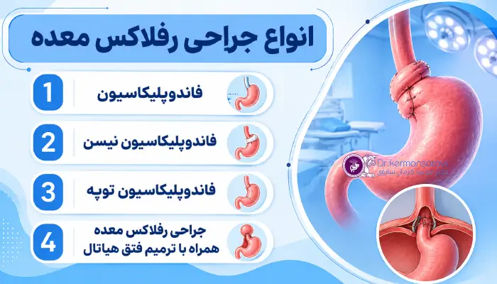 انواع جراحی رفلاکس معده