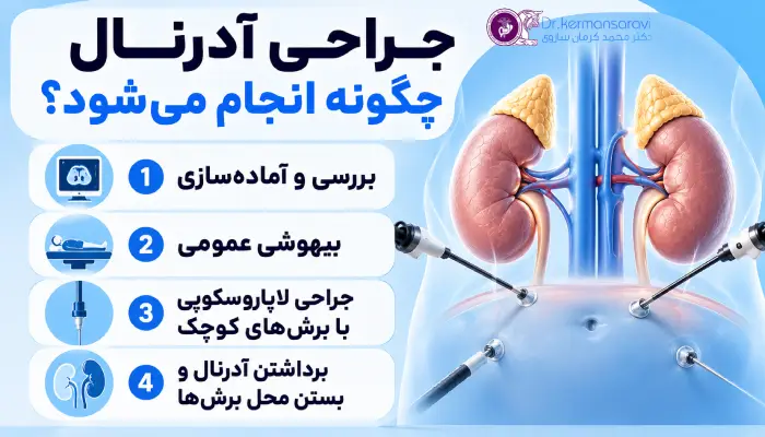جراحی آدرنال چگونه انجام میشود؟
