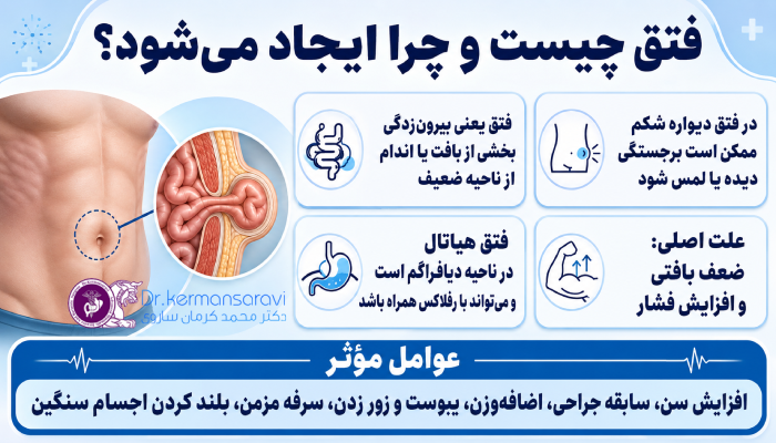 فتق چیست و چرا ایجاد میشود؟