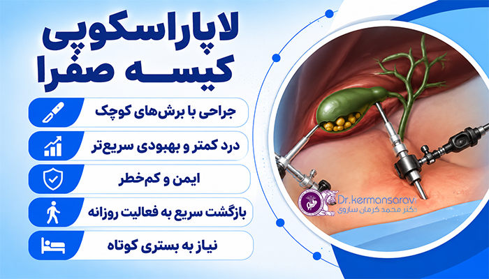 لاپاراسکوپی کیسه صفرا