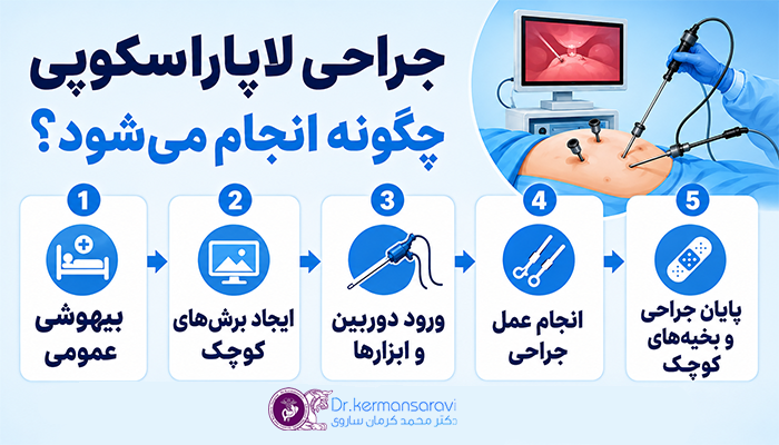 نحوه انجام جراحی لاپاراسکوپی
