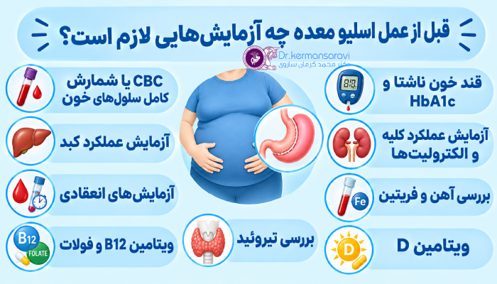 قبل از عمل اسلیو معده چه آزمایشهایی لازم است؟