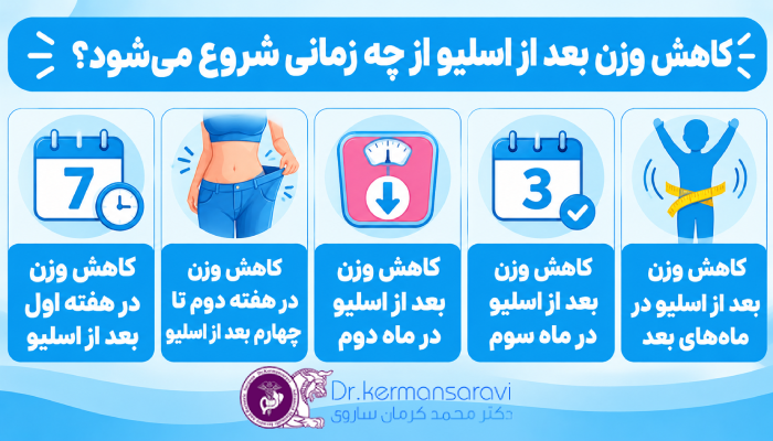کاهش وزن بعد از اسلیو از چه زمانی شروع میشود؟