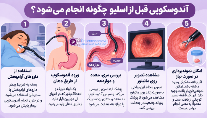 آندوسکوپی قبل از اسلیو چگونه انجام میشود؟
