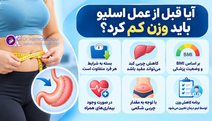 آیا قبل از عمل اسلیو باید وزن کم کرد؟